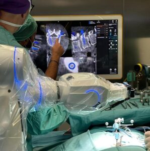 Cardarelli, robot da 2,5 mln di euro affianca i neurochirurghi in sala operatoria